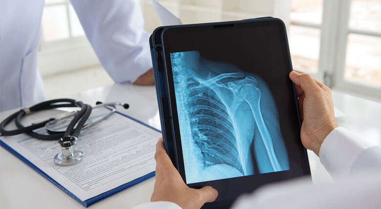Doctor holding an iPad with a scan of a patient's shoulder