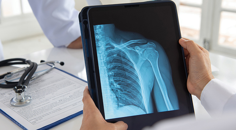 A person holds a tablet showing an X-ray of a shoulder, while a medical professional in a white coat sits in the background.