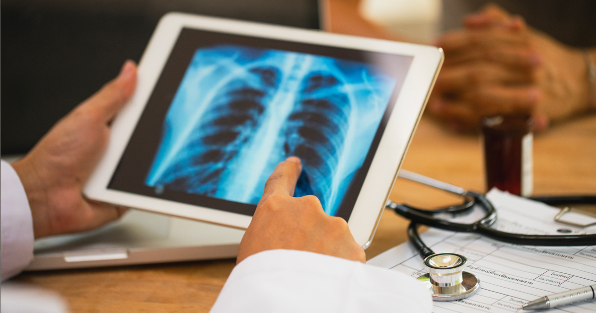 A medical professional points to an X-ray on a tablet.