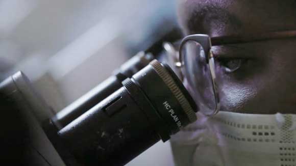 Closeup view of a black cytopathology fellow examining material under a microscope.