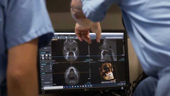 Two oral and maxiloofacial surgery residents review a patient's scans.