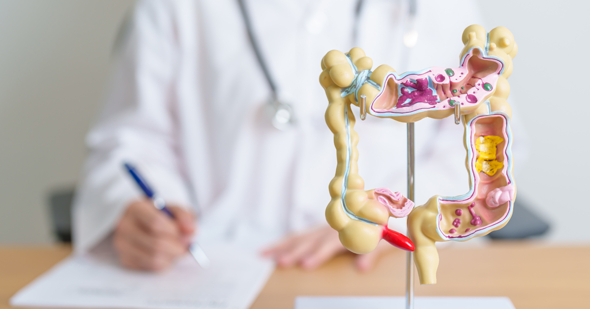 Model of colon