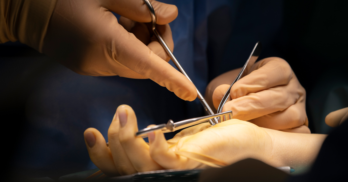 A medical professional in gloves holds shiny tools over a patient's hand during surgery.