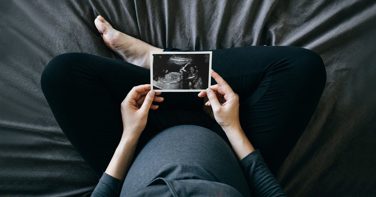 Woman holding ultrasound image