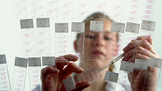 A lab technician examining several flat glass slides with labels on them that are laid out in front of her.