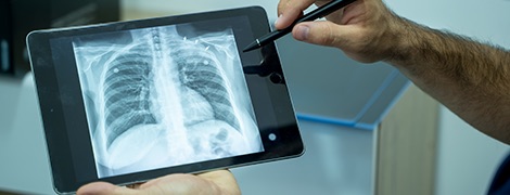An AHN doctor looking at a chest x-ray on a tablet.