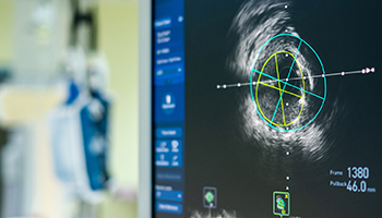 An black and white image of a heart on the monitor of advanced cardiology equipment