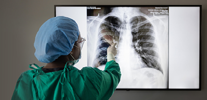 A physician points to a chest x-ray during Kaposi Sarcoma diagnosis at Allegheny Health Network