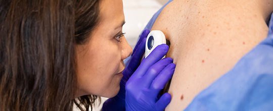 A dermatologist wearing blue gloves examines a patient's skin with a dermatoscope during a melanoma screening at AHN.