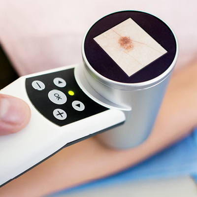 Skin analysis tool used in the diagnosis of Merkel cell carcinoma being used on a patient's arm