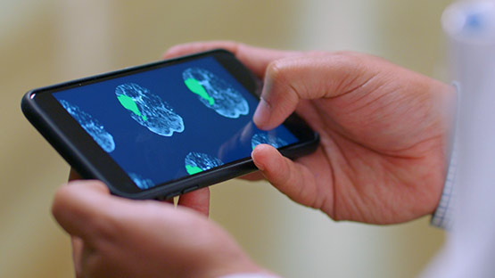 A doctor holding a phone with an innovative rapid CT scan on it.